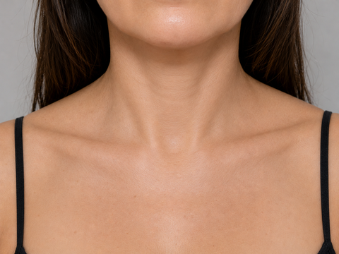 After · Décolletage