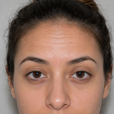 Before · Forehead