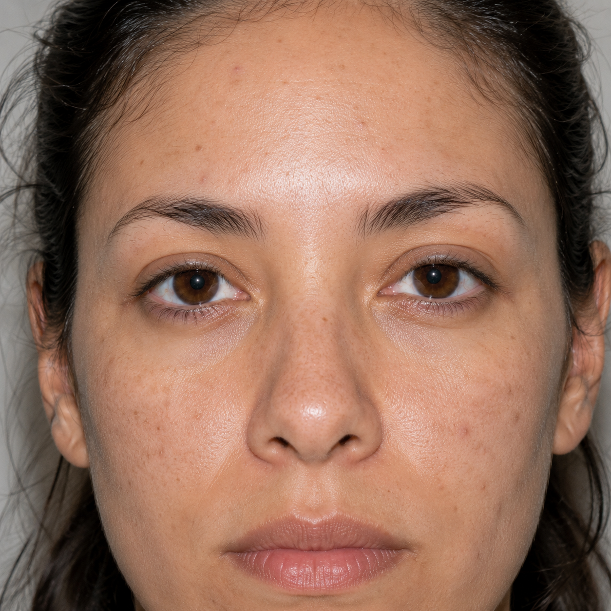 A brighter, more even complexion — before
